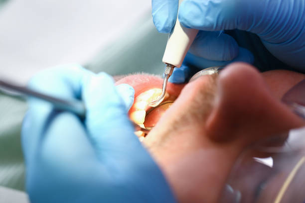 Best Emergency Orthodontic Repairs in Bellevle, IL