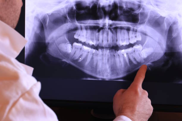 Best Weekend Emergency Dentist in Bellevle, IL