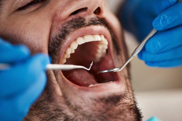 Best Walk-In Emergency Dentist in Bellevle, IL